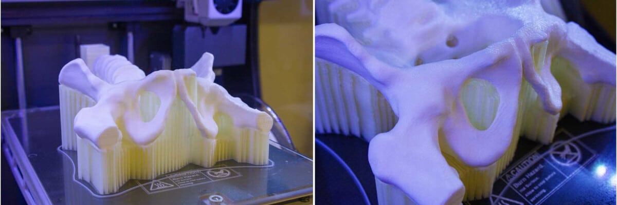 Druk 3D jako nowa metoda pracy dla chirurgów